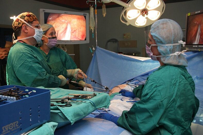 Chirurgie pro prostatitida